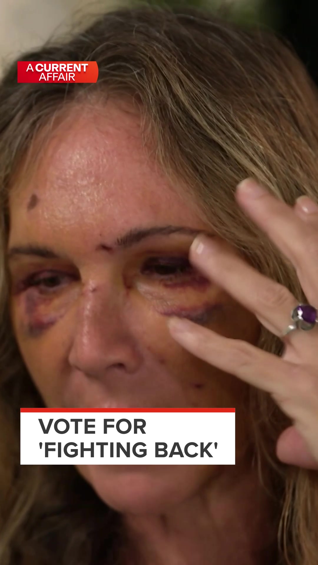 This is a recap of our Logie nomination: Fighting Back.  Vote 'Fighting Back' for the TV WEEK Logie Award HERE